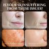 Essence Combination, Anti-aging Firming Hydrating And Brightening Dark Yellow Skin Essence